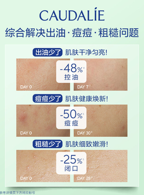 【U先试用】欧缇丽油皮小绿瓶精华10ml，每个ID限购1件
