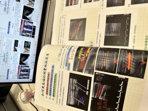 超声笔记医学超声诊断规培结业考手写超声笔记A4铜版纸复印纸打印 - 图1