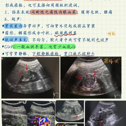 超声笔记医学超声诊断规培结业考手写超声笔记A4铜版纸复印纸打印 - 图3