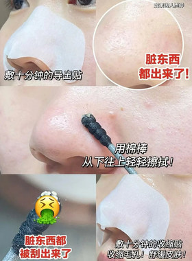 黑头吸尘器~CNP鼻贴去韩