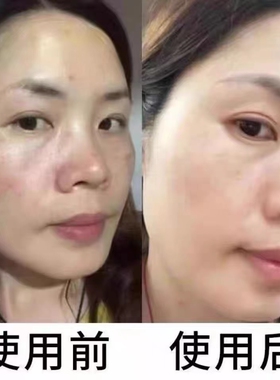 老中医升级版修护套盒 爱诺 提亮去黄补水保湿早晚霜