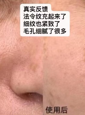 164.88人源胶原次抛精华真淡纹