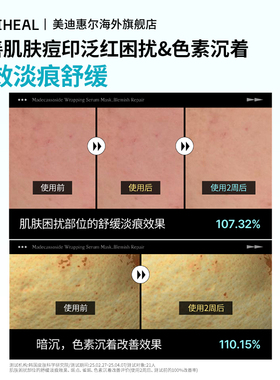 【百亿补贴】美迪惠尔小方瓶精华积雪草茶树补水保湿提亮面膜10片