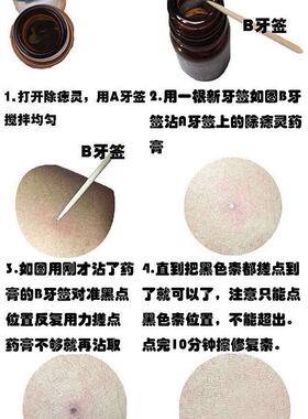 正品韦医生去痣点痣药水点痣膏点斑水灵雀斑祛痣产品脸部