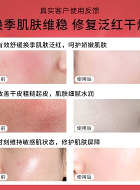 舒缓修复肌肤屏障受损修护水改善脸部发红红血丝过敏补水保湿维稳