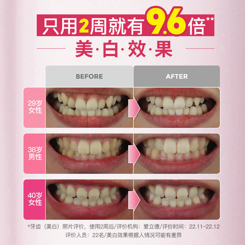 LG官方正品竹盐喜马拉雅 粉盐 紫色色修亮白牙膏清新口气100g,淘宝优惠券,粉丝福利购,淘宝优惠卷