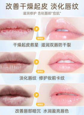 资生堂唇炎唇膏改善唇纹修复干裂