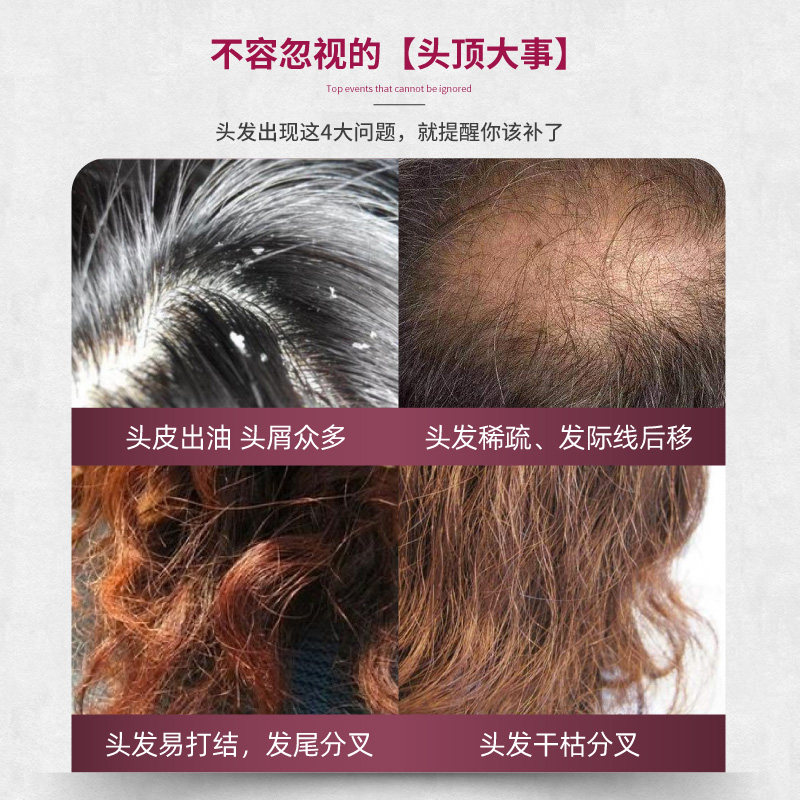 德国奥适宝护发养发头发族生物素 orthomol奥适宝海外B族维生素