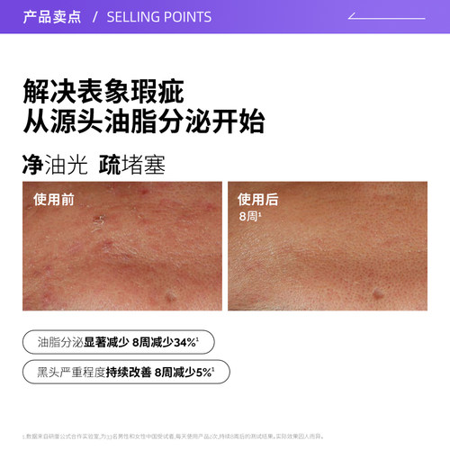 【自营】The Ordinary10%烟酰胺+1%锌精华提亮控油改善痘痘30ml - 图0