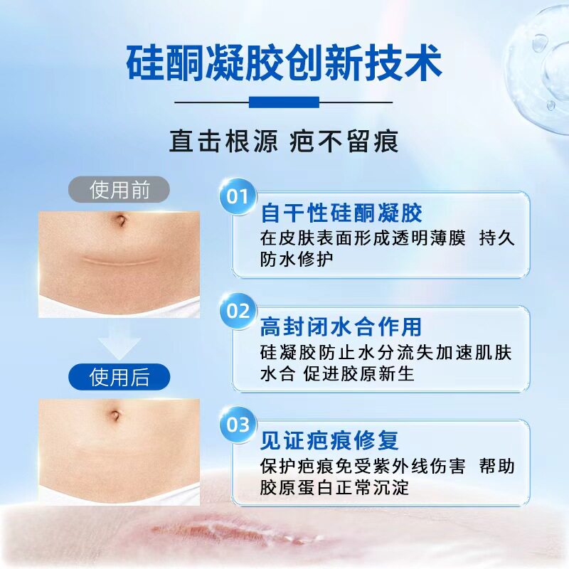 【自营】dermatix舒痕祛疤膏凝胶15g疤痕修复除疤膏疤痕膏去疤