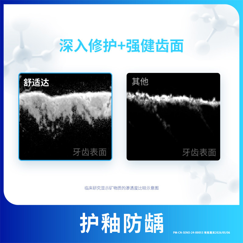 【自营】舒适达牙膏劲速护理多效护理牙龈呵护含氟防蛀清新口气,淘宝优惠券,粉丝福利购,淘宝优惠卷