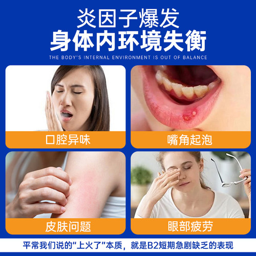 【自营】nutricost美国进口维生素vb2大含量400mg核黄素官方旗舰 - 图0