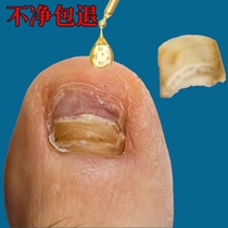 Küchens - effect is too good to be removed without pain removing the hands and feet to refer to the new potassium activity in the old Bundesliga.