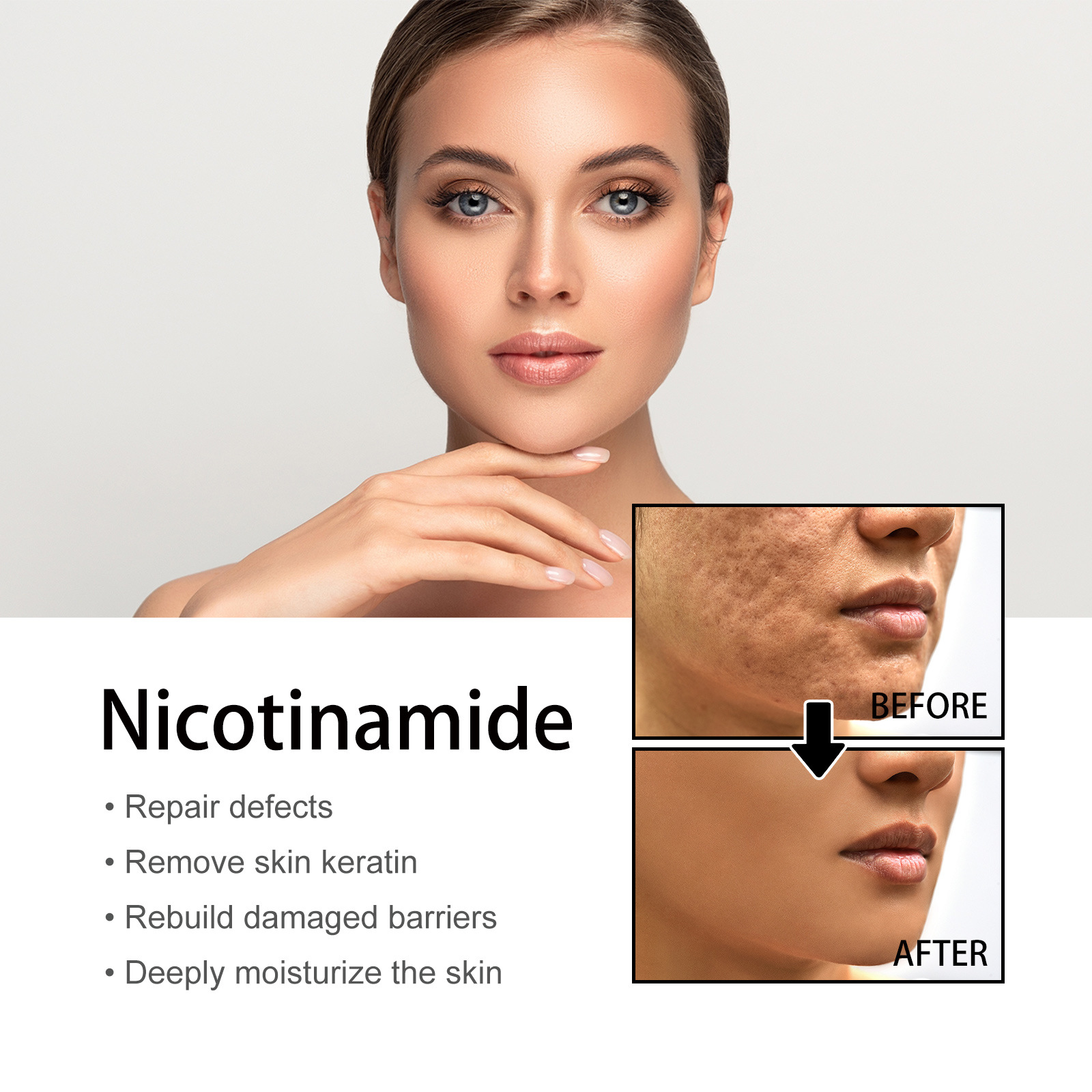 Niacin facial essence liquid moisturizes Fade acne marks - 图0