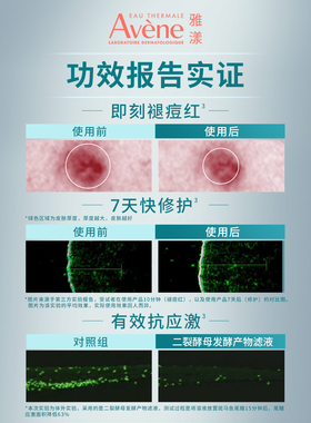 【双11立即预订】雅漾祛痘舒缓面膜小黑膜控油修护褪痘红清洁毛孔