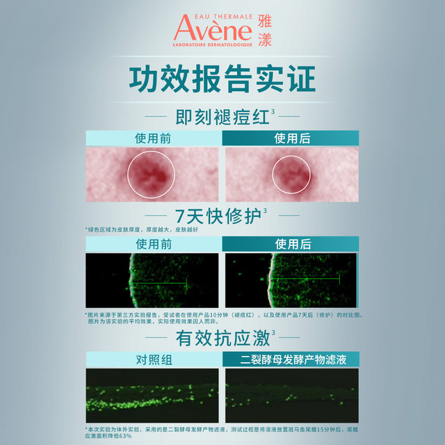 Avène Acne Soothing Mask ຫນ້າກາກສີດໍາຂະຫນາດນ້ອຍ ການຄວບຄຸມນໍ້າມັນ ສ້ອມແປງຮອຍແດງ ຮູຂຸມຂົນສະອາດ
