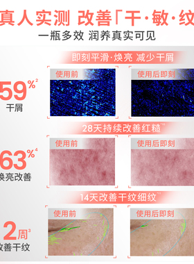 【达人直播专属】雅漾专研修护精华油紧致滋养抗皱精油以油养肤