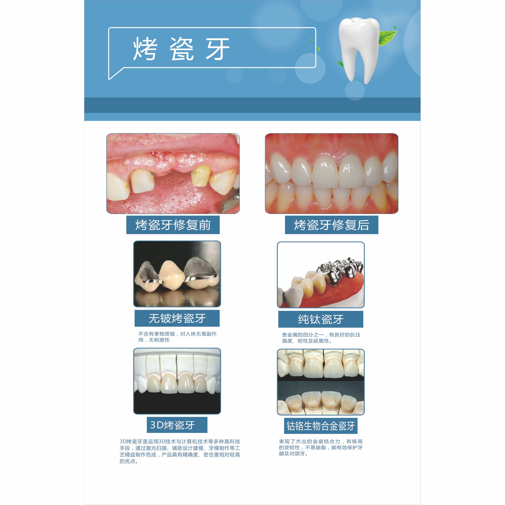 新版牙科诊所挂画宣传海报贴纸医院口腔科墙面无框画装饰挂图定制-图3