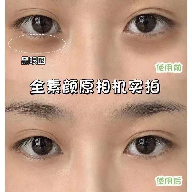 【拍1发3】牛油果眼霜淡化细纹黑眼圈眼袋水肿抗皱去脂肪粒正品