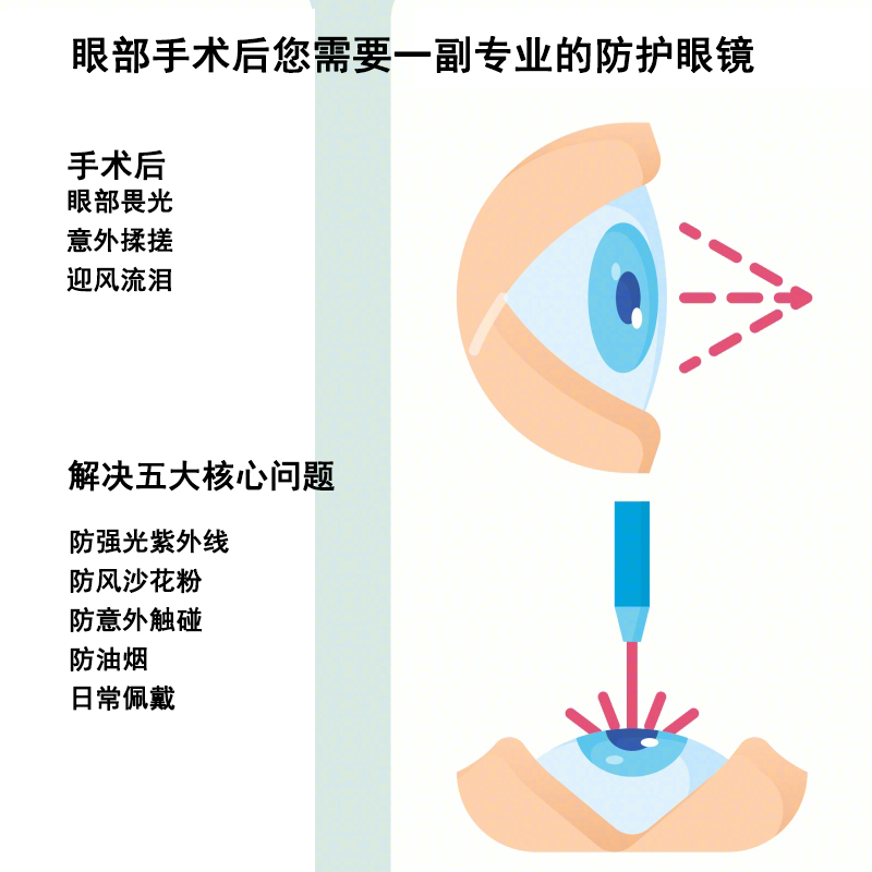 镭蓝眼睛护目近视眼术后防护眼镜激光科手术白内畏光眼怕光墨镜-图0