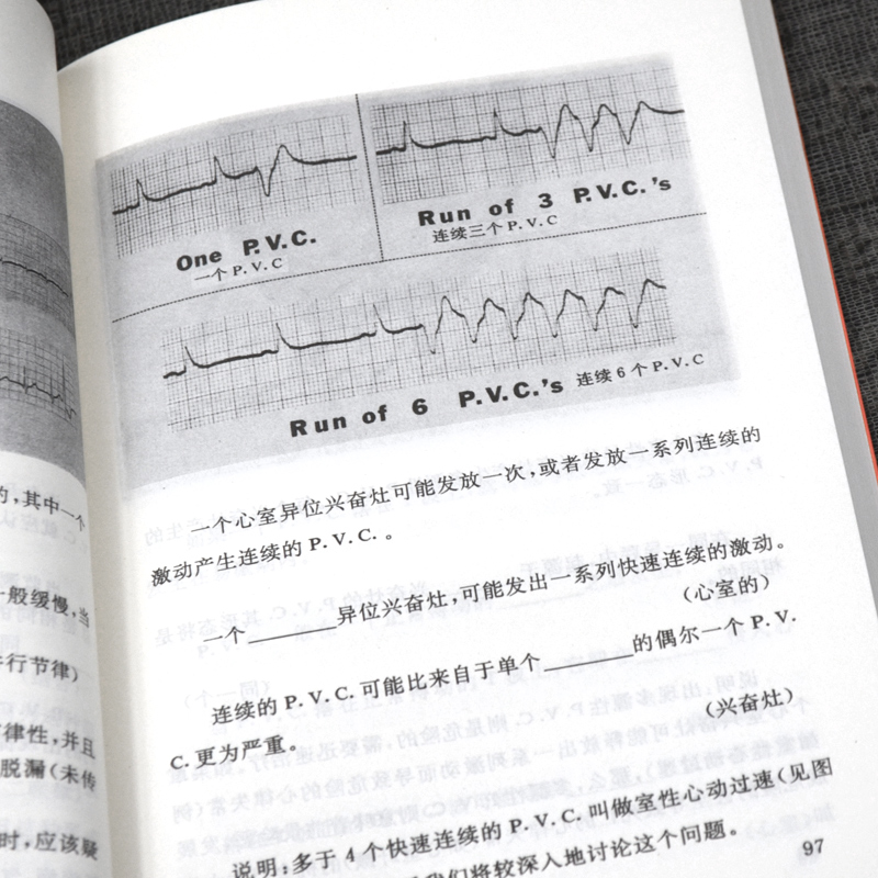 【官方直营】心电图图解速成讲授  王建华 心电图基本原理 心电图实例 心电图诊断手册 心电图普 心电图书籍医学影像书籍 - 图1