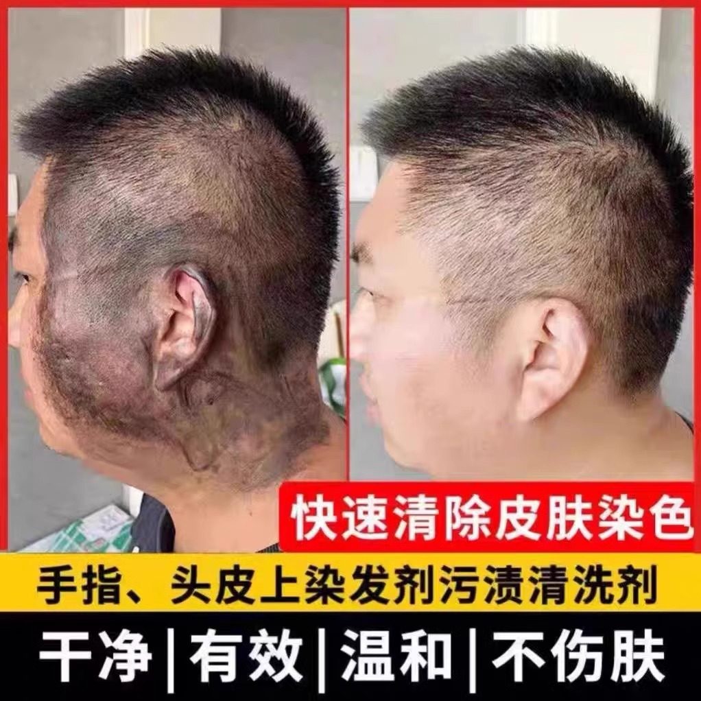 一擦净轻松去除染发剂粘头皮去染发膏头皮残留清理衣服染色清洗剂,淘宝优惠券,粉丝福利购,淘宝优惠卷
