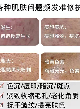 蓝精灵蓝藻海绵微晶小蓝膜焕肤美容院用去黄提亮痘印痘痘清洁毛孔