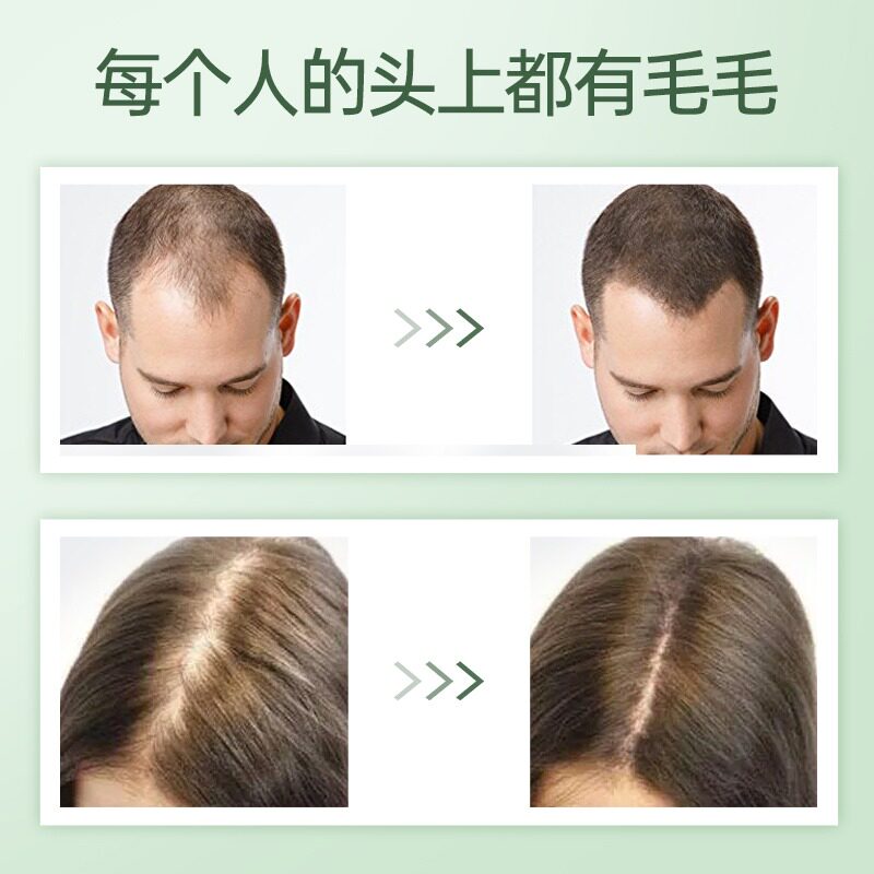日本jg长生堂生发液男女防脱增发密发育发液非凝胶精华营养液R_虎窝淘