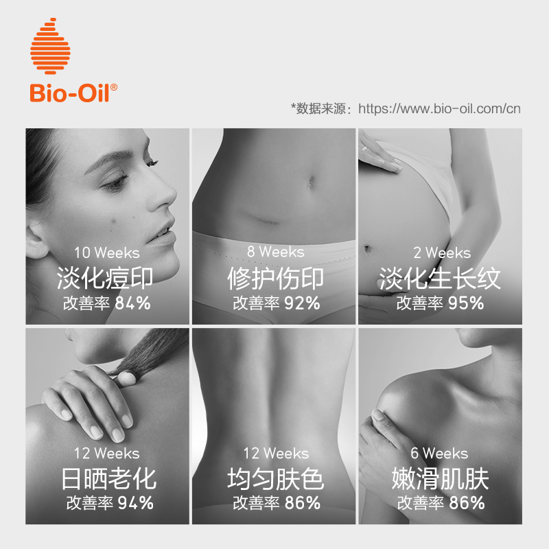 百洛旗舰店bio oil百洛油125ml润肤身体乳霜女全身滋润润体乳角质身体保湿dy2