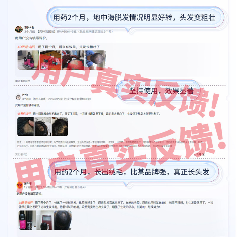 顺丰达霏欣60ml防脱发米诺地尔搽剂 欣舟大药房白发脱发