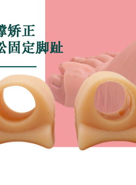 拇外翻重叠大脚骨分指器