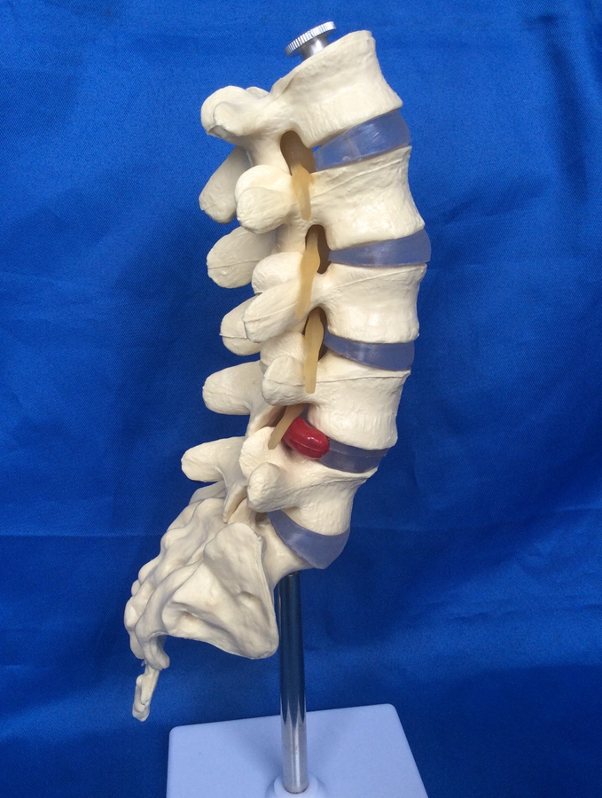 包邮 人体1:1五节腰椎（可拆）骨骼骨架 医用教学模型 - 图1