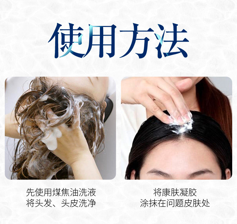 头皮毛囊炎膏止痒神器私处xc洗发水 岳家老铺大药房皮肤消毒护理（消）