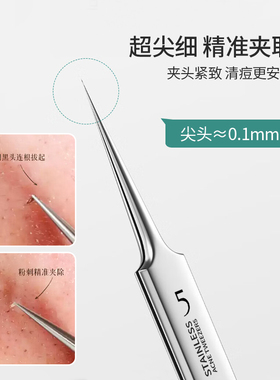 UPLUS优家5号细胞夹超尖粉刺针