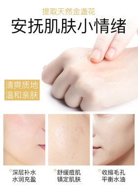香港NCCU金盏花爽肤水女补水保湿收缩毛孔控油清爽湿敷水