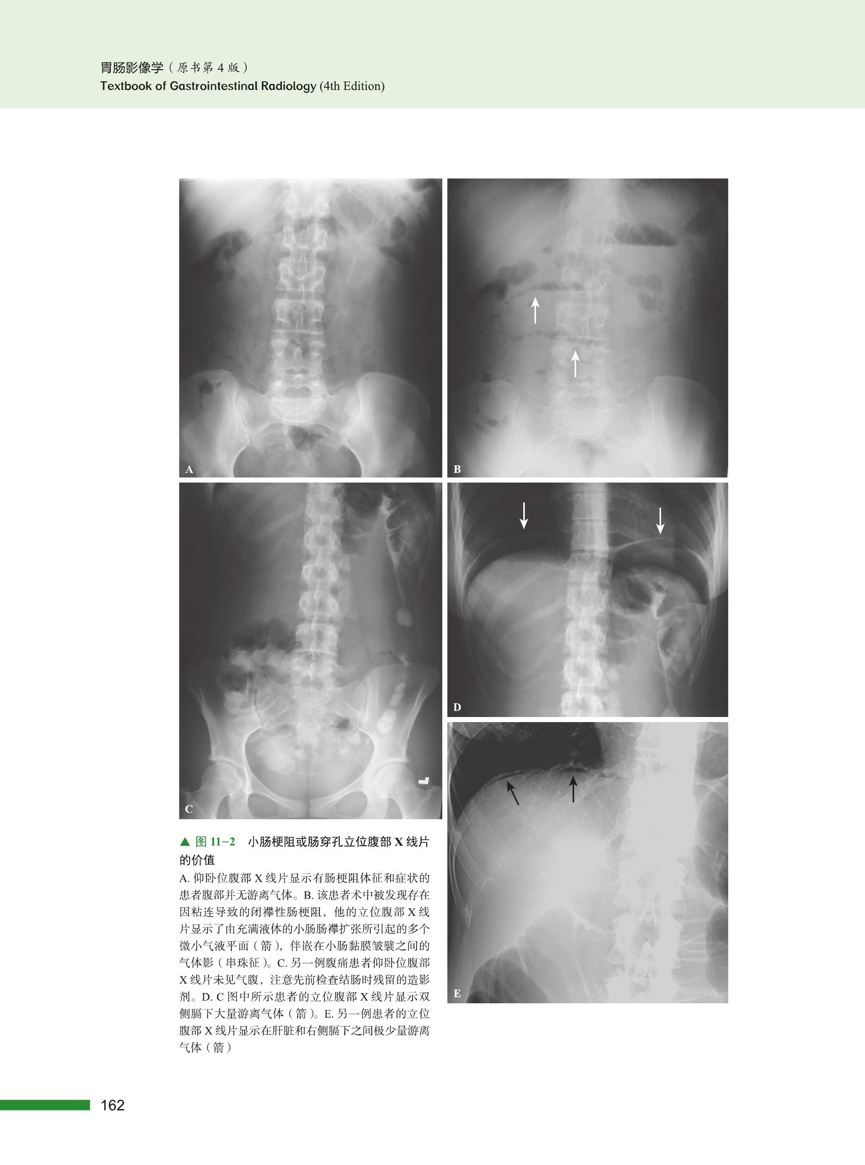胃肠影像学 原书第4版 全球176位权威专家倾力打造 胃肠影像诊断影像医学 胃肠病专业医学书籍 - 图2