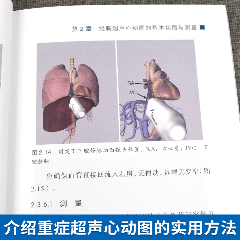 正版书籍 ICU超声心动图  邢长洋 袁丽君 主译  世界图书西安  评估血流动力学衰竭所设计的超声心动图袖珍指南  重症超声心动图 - 图1