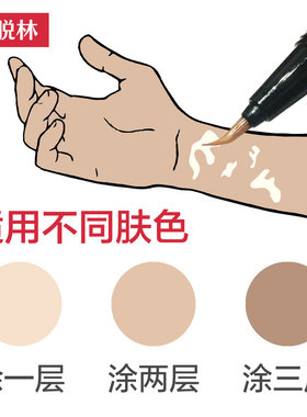 【盖脱林白斑遮盖笔】白癜風遮瑕液防水肤色膏外用白斑促黑色素