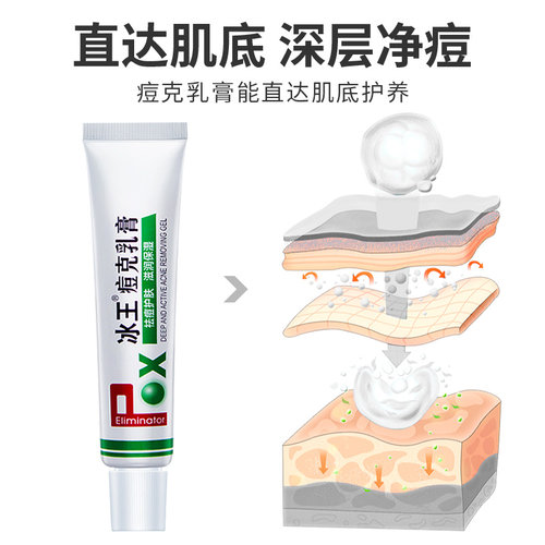 冰王痘克清痘乳膏祛痘去痘印痘坑淡化消印痘疤凝胶正品男士女学生 - 图2