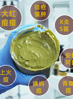 痘肌灭火器金银花积雪草黄连面膜上火痘大红痘姨妈痘毛孔配方