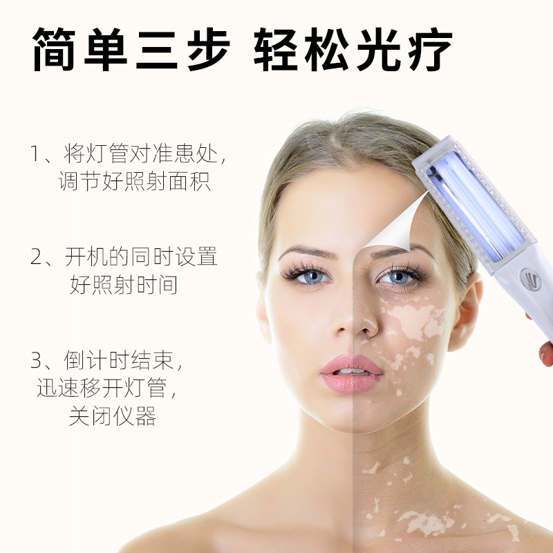 诺威娜银屑病治疗仪白癜风光疗仪 三奥医疗器械理疗仪（器械）