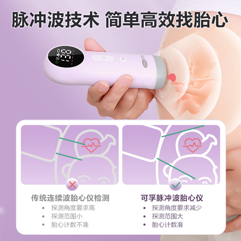 Listening fetal heart rate monitor to monitor pregnant women's household radiation-free early pregnancy fetal mover all-in-one portable hospital model