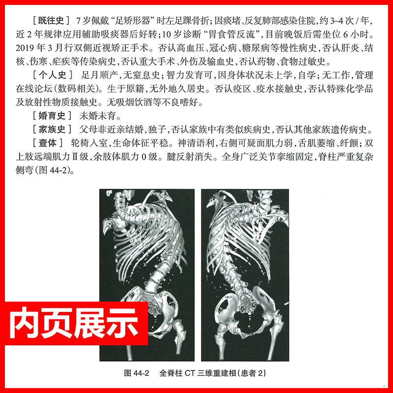 正版 北京协和医院罕见病多学科合作诊疗病例集 2021年版张抒扬实用内科学协和住院医师手册心电图心脏起搏器肾脏人民卫生出版社
