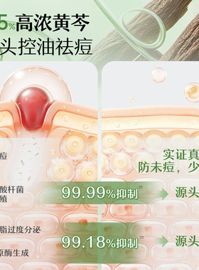 青少年黄芩祛痘控油洁面泡泡