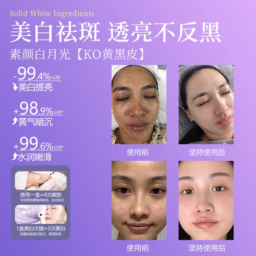 【柏兰梦正品】美白祛斑水光精华液淡斑祛斑提亮暗沉淡化痘印原液 - 图0