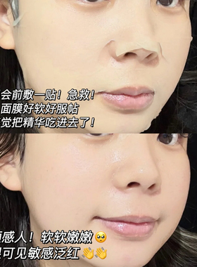 瑷尔博士面膜补水保湿