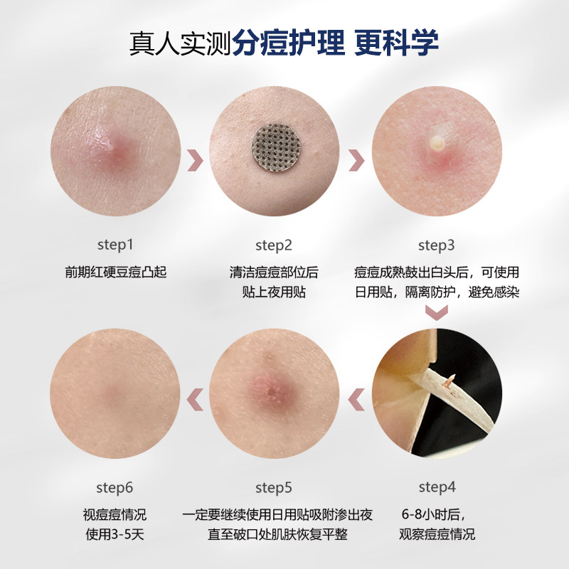 COJAJI可嘉净痘痘贴隐形修护祛痘遮痘印急救可上妆日夜用27贴,淘宝优惠券,粉丝福利购,淘宝优惠卷