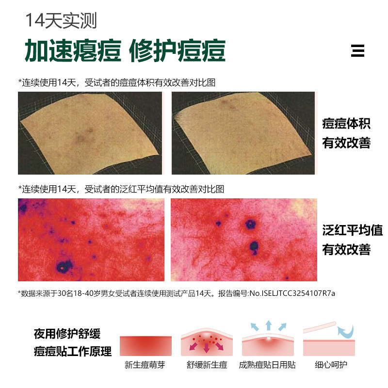 COJAJI可嘉净痘痘贴修护祛痘遮痘印急救可上妆夜用12贴正品,淘宝优惠券,粉丝福利购,淘宝优惠卷