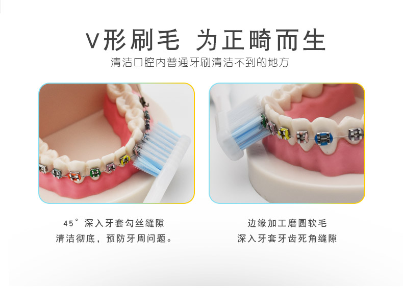 日本丹特博正畸整牙专用牙刷2把装V型凹软毛便携箍牙矫正齿带牙套