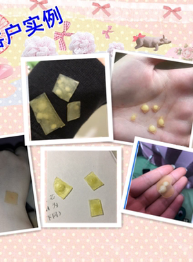 台湾3M人工皮痘痘贴防水点痣化妆